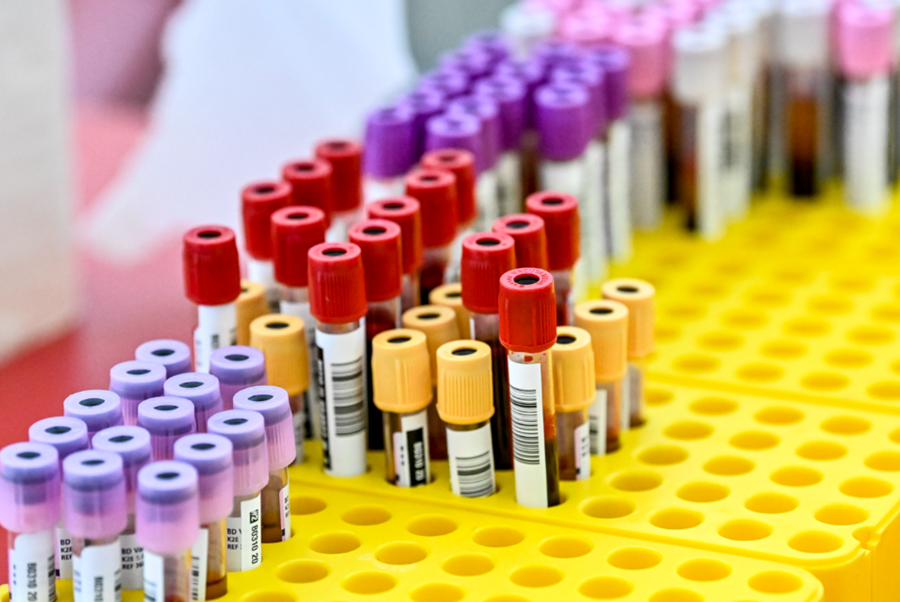 Rode Kruis-Vlaanderen wil record van 5.000 plasmadonaties