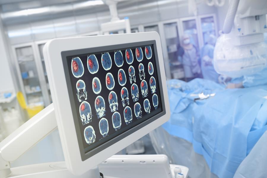 Beroertezorg in België: "Time is brain"